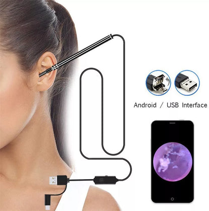 Endoscope Auriculaire Professionnel