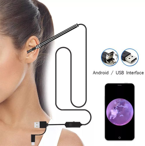 Endoscope Auriculaire Professionnel